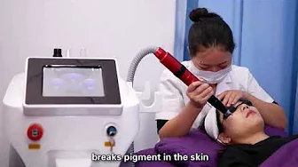 Professional Portable Picosecond Laser Tattoo Removal Machine Looking for Distributors